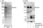 PHIP Antibody in Western Blot (WB)