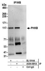 PHKB Antibody in Western Blot (WB)