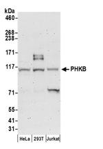 PHKB Antibody in Western Blot (WB)