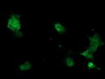 PHKG2 Antibody in Immunocytochemistry (ICC/IF)