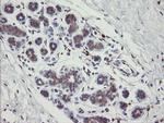 PHKG2 Antibody in Immunohistochemistry (Paraffin) (IHC (P))