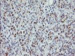 PHKG2 Antibody in Immunohistochemistry (Paraffin) (IHC (P))