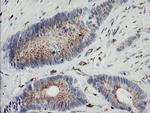 PHKG2 Antibody in Immunohistochemistry (Paraffin) (IHC (P))