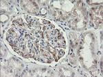 PHKG2 Antibody in Immunohistochemistry (Paraffin) (IHC (P))