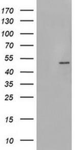 PHKG2 Antibody in Western Blot (WB)