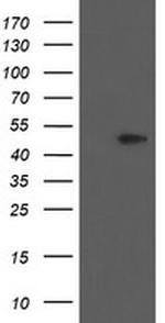 PHKG2 Antibody in Western Blot (WB)