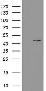 PHKG2 Antibody in Western Blot (WB)