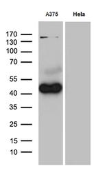 PHLDA1 Antibody in Western Blot (WB)