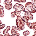 PI3K p85 alpha Antibody in Immunohistochemistry (Paraffin) (IHC (P))