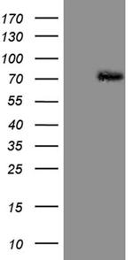 PIAS2 Antibody in Western Blot (WB)