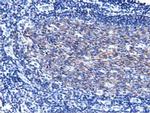 PIK3AP1 Antibody in Immunohistochemistry (Paraffin) (IHC (P))