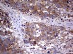 PIK3C2A Antibody in Immunohistochemistry (Paraffin) (IHC (P))