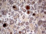 PIK3C2A Antibody in Immunohistochemistry (Paraffin) (IHC (P))