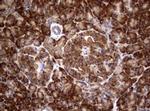 PIK3C2A Antibody in Immunohistochemistry (Paraffin) (IHC (P))