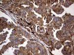 PIK3C2A Antibody in Immunohistochemistry (Paraffin) (IHC (P))