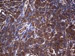 PIK3C2A Antibody in Immunohistochemistry (Paraffin) (IHC (P))