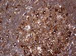 PIK3C2A Antibody in Immunohistochemistry (Paraffin) (IHC (P))