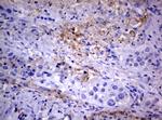 PIK3C2A Antibody in Immunohistochemistry (Paraffin) (IHC (P))