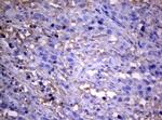 PIK3C2A Antibody in Immunohistochemistry (Paraffin) (IHC (P))