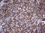 PIK3C2A Antibody in Immunohistochemistry (Paraffin) (IHC (P))