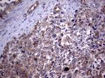 PIK3C2A Antibody in Immunohistochemistry (Paraffin) (IHC (P))