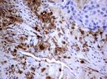 PIK3C2A Antibody in Immunohistochemistry (Paraffin) (IHC (P))