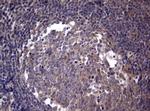 PIK3C2A Antibody in Immunohistochemistry (Paraffin) (IHC (P))