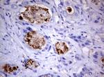 PIK3C2A Antibody in Immunohistochemistry (Paraffin) (IHC (P))