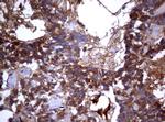 PIK3C2A Antibody in Immunohistochemistry (Paraffin) (IHC (P))