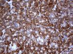 PIK3C2A Antibody in Immunohistochemistry (Paraffin) (IHC (P))