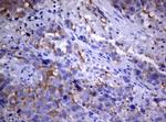 PIK3C2A Antibody in Immunohistochemistry (Paraffin) (IHC (P))