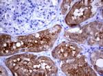 PIK3C2A Antibody in Immunohistochemistry (Paraffin) (IHC (P))