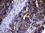 PIK3C2A Antibody in Immunohistochemistry (Paraffin) (IHC (P))