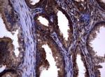 PIK3C2A Antibody in Immunohistochemistry (Paraffin) (IHC (P))