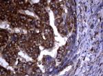 PIK3C2A Antibody in Immunohistochemistry (Paraffin) (IHC (P))