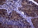 PIK3C2A Antibody in Immunohistochemistry (Paraffin) (IHC (P))