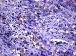 PIK3C2A Antibody in Immunohistochemistry (Paraffin) (IHC (P))