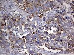 PIK3C2A Antibody in Immunohistochemistry (Paraffin) (IHC (P))