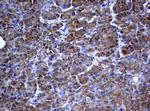 PIK3C2A Antibody in Immunohistochemistry (Paraffin) (IHC (P))