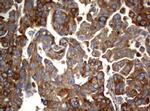 PIK3C2A Antibody in Immunohistochemistry (Paraffin) (IHC (P))