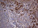 PIK3C2A Antibody in Immunohistochemistry (Paraffin) (IHC (P))