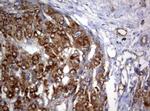 PIK3C2A Antibody in Immunohistochemistry (Paraffin) (IHC (P))