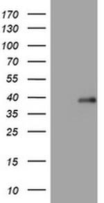 PIK3C2A Antibody in Western Blot (WB)