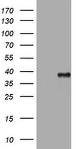 PIK3C2A Antibody in Western Blot (WB)