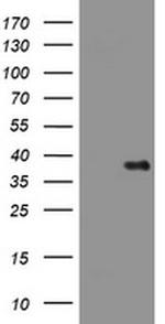 PIK3C2A Antibody in Western Blot (WB)