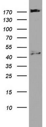 PIK3C2A Antibody in Western Blot (WB)