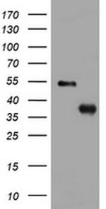 PIK3C2A Antibody in Western Blot (WB)