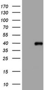 PIK3C2A Antibody in Western Blot (WB)