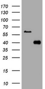 PIK3C2A Antibody in Western Blot (WB)