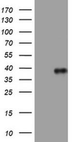 PIK3C2A Antibody in Western Blot (WB)